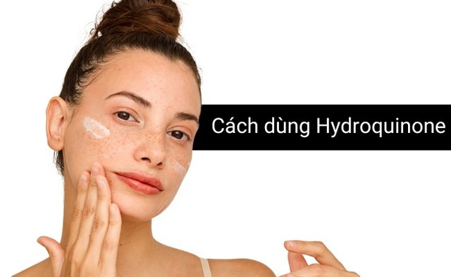 Top 5 sản phẩm chứa Hydroquinone trị nám, sáng da được chuyên gia da liễu tin dùng - Ảnh 9.