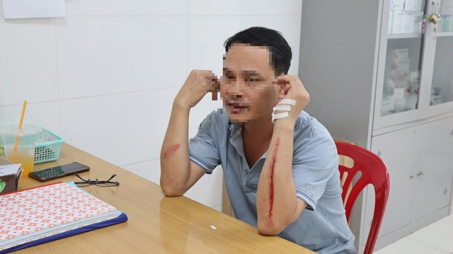 Điều tra vụ điều dưỡng Bệnh viện Đa khoa tỉnh Bình Phước bị hành hung - Ảnh 3.