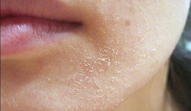 Rejuvaskin Skin Recovery - Kem dưỡng ẩm không thể thiếu vào mùa đông - Ảnh 2.