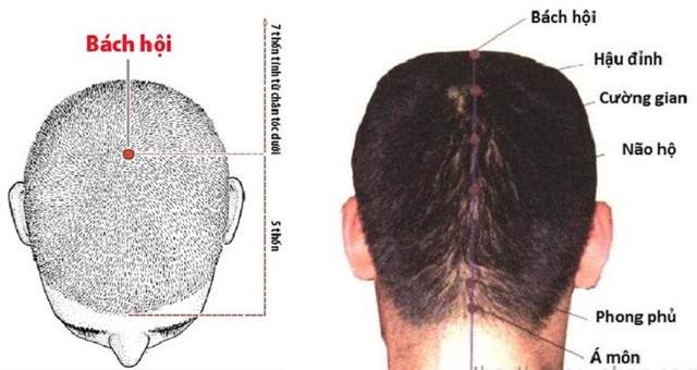 Các huyệt đạo trên vùng đầu ảnh hưởng đến sức khỏe