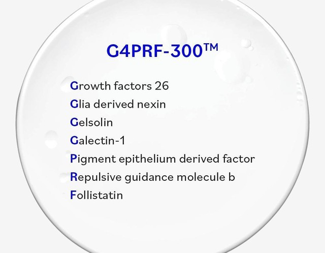 Exosome chứa G4PRF-300™ - Lựa chọn mới trong phục hồi nang tóc hiệu quả- Ảnh 4.