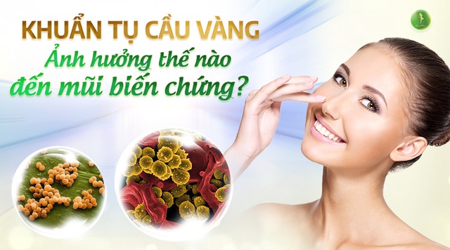 Khuẩn tụ cầu vàng ảnh hưởng thế nào đến mũi biến chứng?- Ảnh 1.