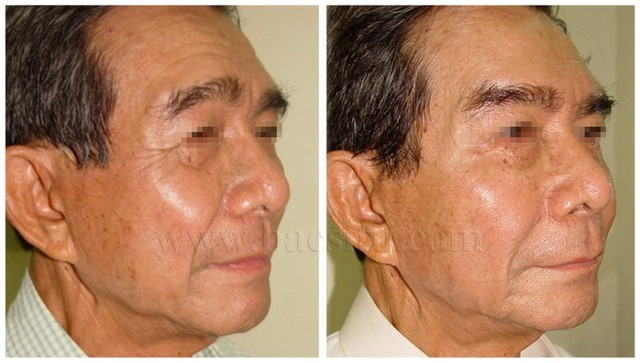 Cuối năm, dập dìu đi làm đẹp an toàn đón Tết- Ảnh 4. Cuối năm, dập dìu đi làm đẹp an toàn đón Tết- Ảnh 4.