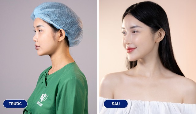 Không bao giờ là quá muộn để bắt đầu làm đẹp - Ảnh 3. Không bao giờ là quá muộn để bắt đầu làm đẹp - Ảnh 3.