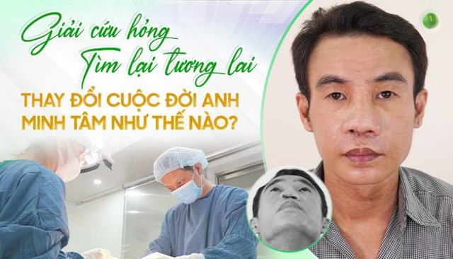 ‘Giải cứu mũi hỏng-Tìm lại tương lai’ thay đổi cuộc đời anh Minh Tâm như thế nào? - Ảnh 1.