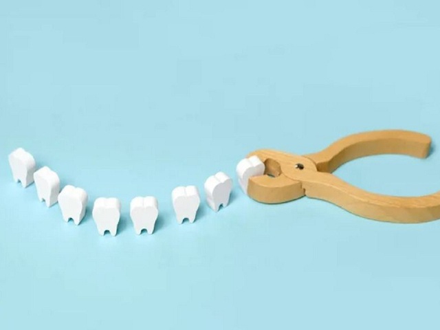 Nếu răng khôn xuất hiện các triệu chứng nhiễm trùng như sưng đỏ nướu, cứng hàm và đau dữ dội thì cần đến nha sĩ càng sớm càng tốt