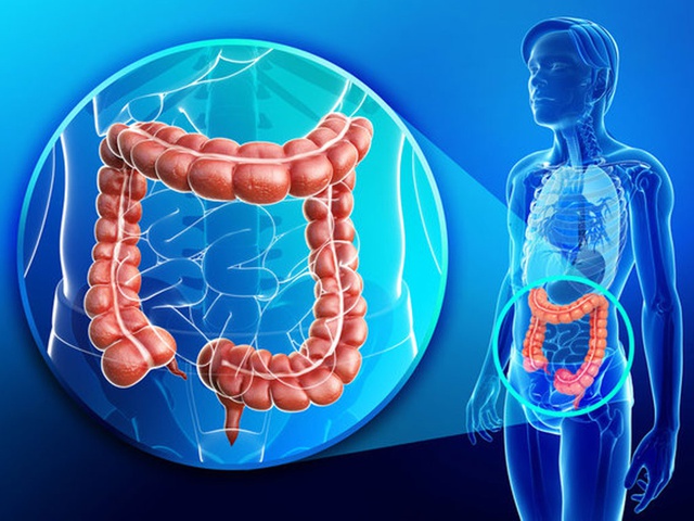 Sưng 1 bên lưỡi, đi khám phát hiện ung thư ruột di căn - Ảnh 1.