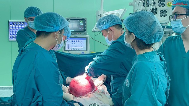 Phẫu thuật lấy khối u nang buồng trứng 5 kg ra khỏi cơ thể bệnh nhân - Ảnh 2.