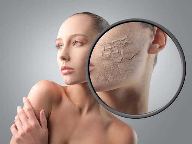 Làn da bị hư tổn nặng nề và khó phục hồi nếu dùng mỹ phẩm kém chất lượng trong thời gian dài