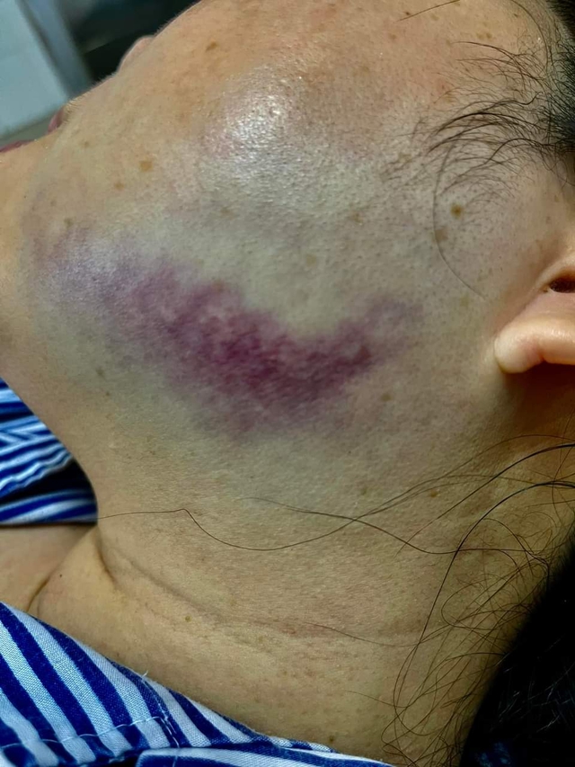 Quảng Ninh: nữ công chứng viên bị người đàn ông nhỏ bọt, đá sưng mặt  - Ảnh 1.