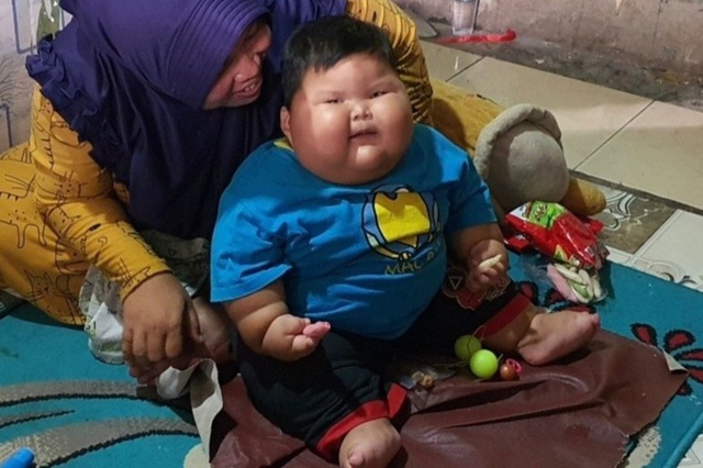 Chuyện lạ: Em bé 16 tháng tuổi đã nặng 27 kg - Ảnh 2.