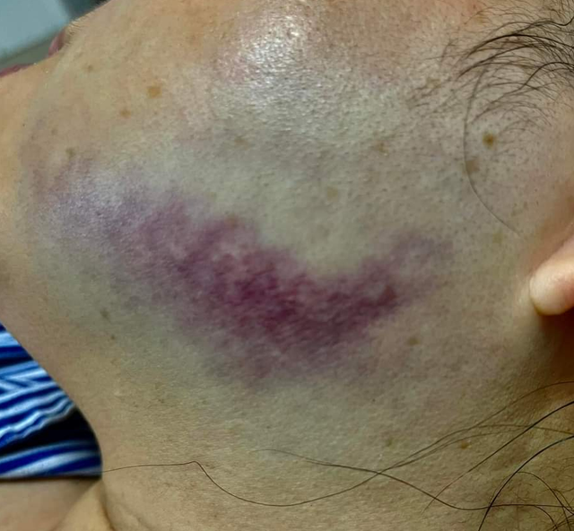 Quảng Ninh: Lĩnh cú 'kungfu' nữ công chứng viên tổn thương 1% cơ thể   - Ảnh 2.
