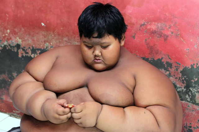 How is the 'fattest boy in the world' now? - Photo 1.