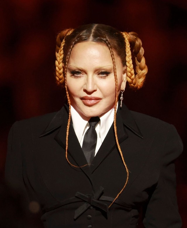 Madonna responded harshly to being criticized for her 'unrecognizable face' - Photo 1.