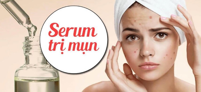 Serum trị mụn nào tốt hiện nay?