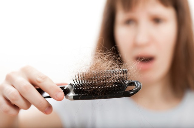 Vì sao phụ nữ không nên bỏ qua chứng rụng tóc? - Ảnh 1.