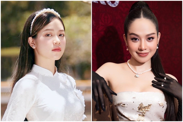 Hoa hậu Việt Nam 2022 thừa nhận phẫu thuật thẩm mỹ - Ảnh 1.