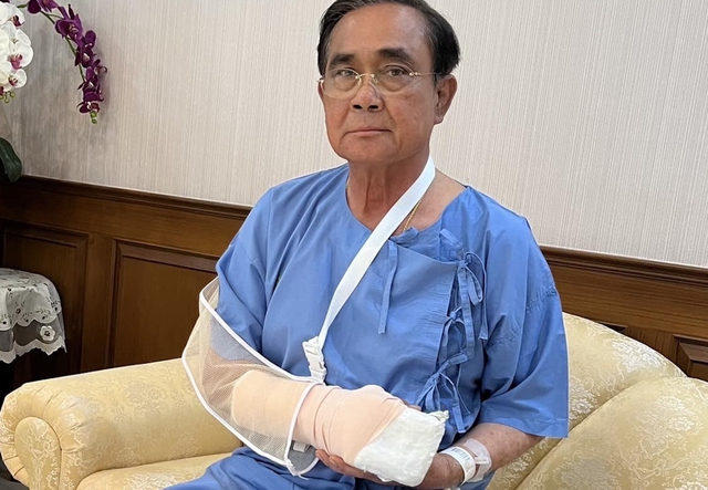 Thủ tướng Thái Lan nhập viện vì bàn tay sưng tấy - Ảnh 1.