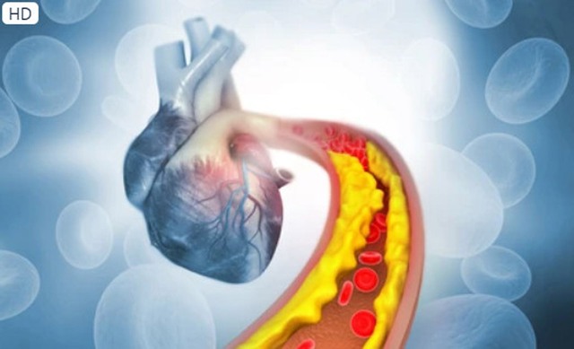 Chuyên gia: 7 thực phẩm hàng đầu giảm cholesterol ngăn ngừa bệnh tim - Ảnh 1.