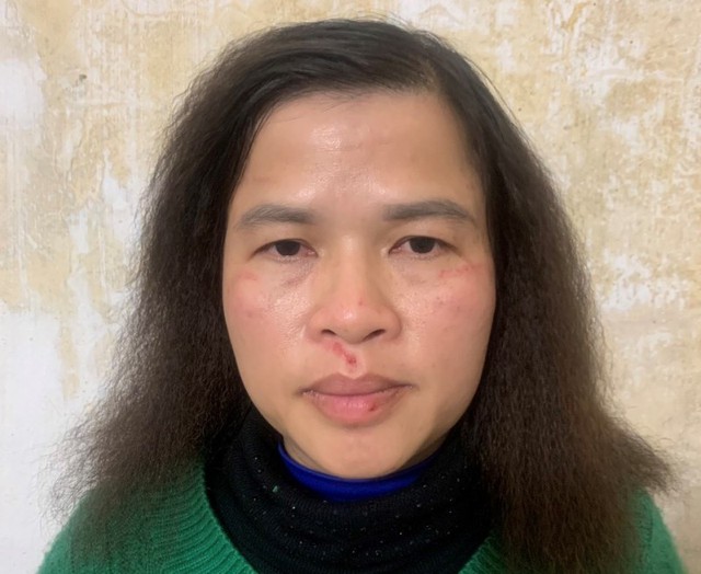 Nguyễn Thị Ái Liên nữ tiểu thương bị khởi tố, bắt giam về hành vi giết người