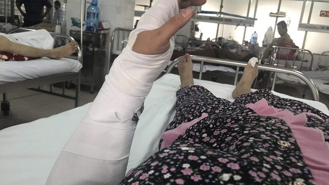 Đà Nẵng: Bị chồng đánh dã man, người phụ nữ cầu cứu mạng xã hội - Ảnh 1.