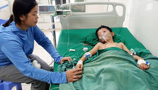 Vụ nổ tại gara ô tô ở Nghệ An: Xót xa gia cảnh 3 trẻ gặp nạn - Ảnh 2.