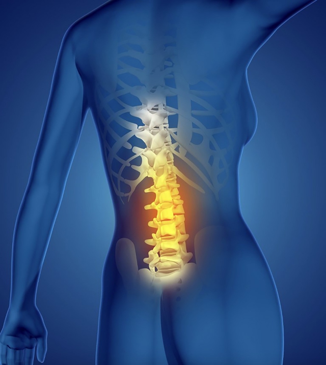Điều trị thoát vị đĩa đệm đốt sống L4-L5 nhờ phương pháp Chiropractic - Ảnh 1. Điều trị thoát vị đĩa đệm đốt sống L4-L5 nhờ phương pháp Chiropractic - Ảnh 1.