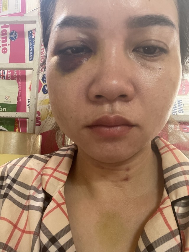 Quảng Trị: Đến nhà chồng cũ đón con, một phụ nữ bị đánh dã man - Ảnh 2.