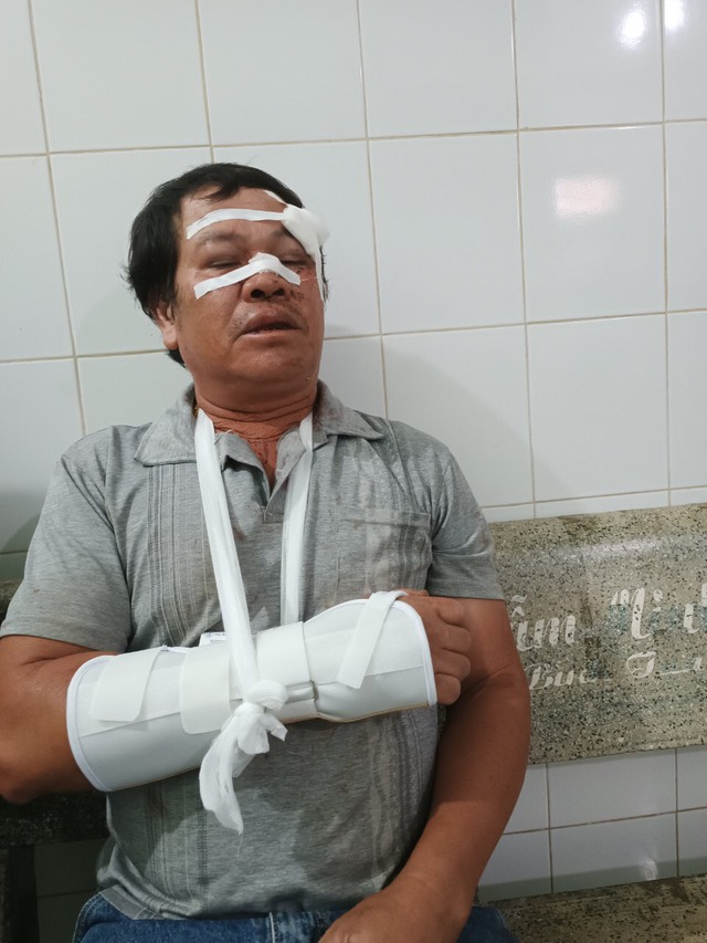Lâm Đồng: Ngang nhiên xông vào nhà đánh, chém 7 người bị thương - Ảnh 2.