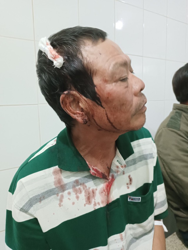 Lâm Đồng: Ngang nhiên xông vào nhà đánh, chém 7 người bị thương - Ảnh 3.