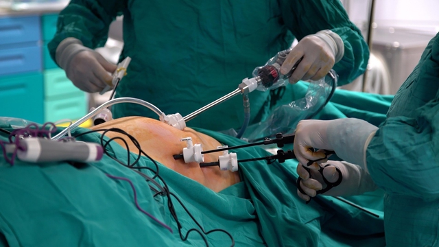 Các bác sĩ Bệnh viện FV thực hiện phẫu thuật cắt tạo hình dạ dày hình ống (Ảnh: FV)