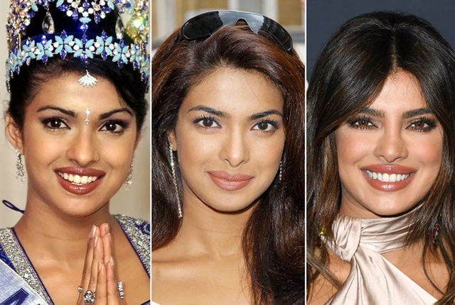 Former Miss World Priyanka Chopra Jonas suffered from 'deep depression' after nose surgery - Photo 2.