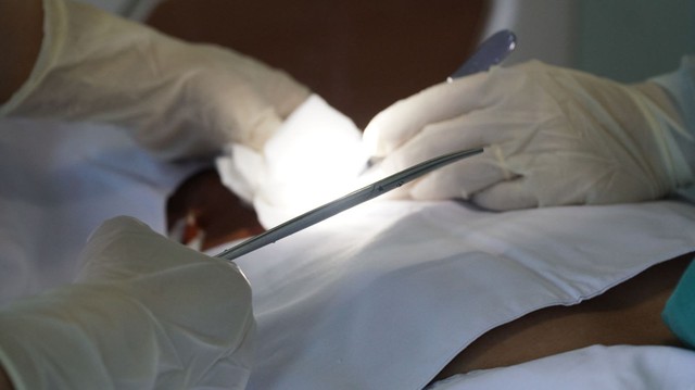 Đắk Lắk: Phẫu thuật thành công cho nam bệnh nhân tự cắt dương vật  - Ảnh 1.