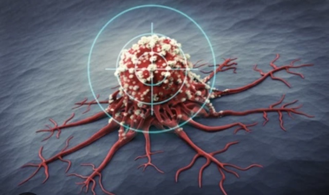 Các nhà khoa học vừa tìm ra cách ăn làm thu nhỏ khối u ung thư   - Ảnh 1.