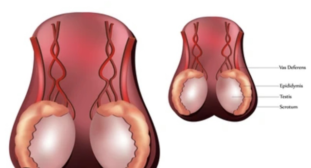 Bác sĩ lưu ý dấu hiệu đừng bao giờ bỏ qua khi kiểm tra tinh hoàn - Ảnh 1.