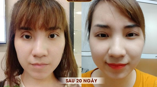 “Công cuộc giải cứu” và làm đẹp lại những đôi mắt bị hỏng do phẫu thuật - Ảnh 6.