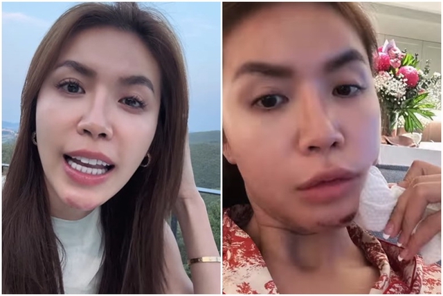 Minh Tú trải lòng về tại nạn khi tham gia gameshow - Ảnh 2. Minh Tú trải lòng về tại nạn khi tham gia gameshow - Ảnh 2.
