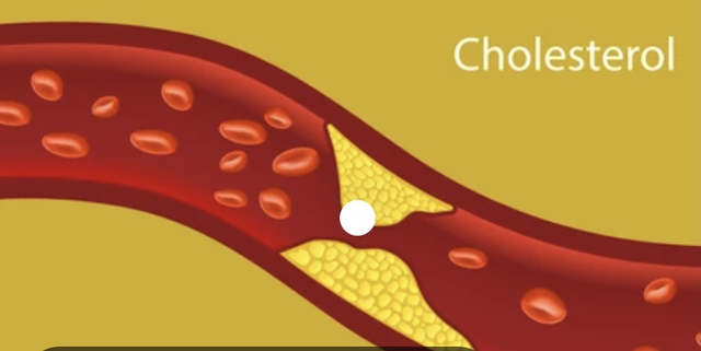Khoa học chỉ ra loại trái &quot;vàng&quot; độc đáo giúp giảm mức cholesterol cao - Ảnh 1.
