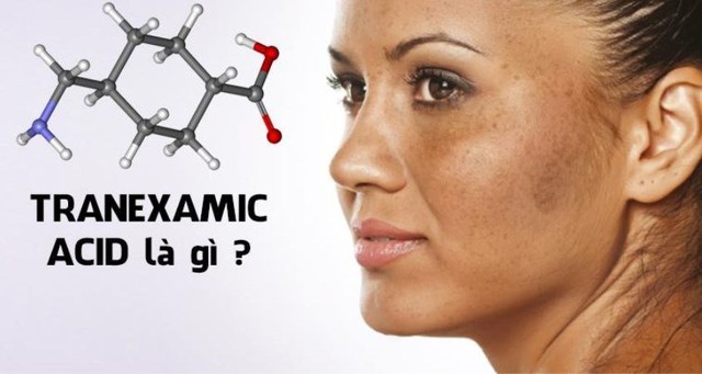 Tranexamic Acid là gì? Tác dụng đối với làn da và những lưu ý khi sử dụng
 - Ảnh 1.