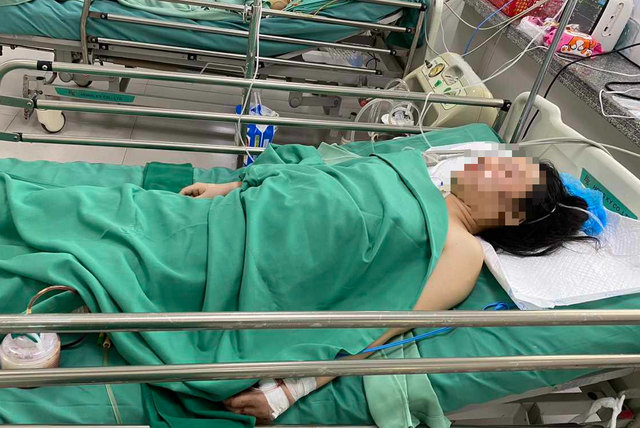 Huy động 10 bác sĩ của 5 chuyên khoa cứu cô gái trẻ bị xe container tông - Ảnh 1.