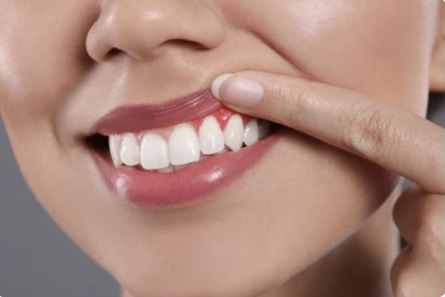 Phát hiện mới: Đánh răng theo cách này có thể gây teo não - Ảnh 2.