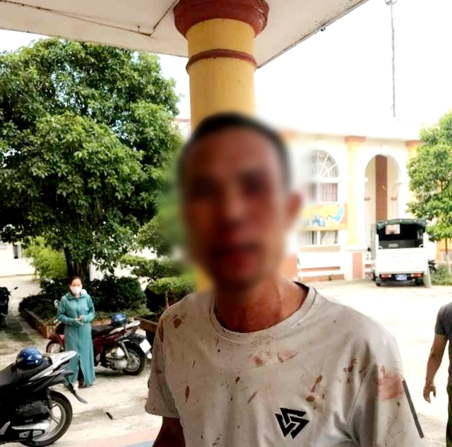 Nguyên nhân công dân ở Hưng Yên bị mời lên công an xã rồi tố bị đánh - Ảnh 2.