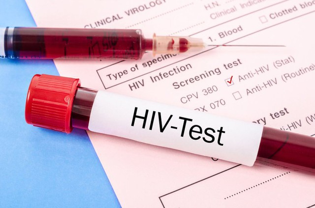 'Bông hồng đen' lấy mẫu xét nghiệm HIV: đề nghị Sở Y tế Hải Phòng báo cáo - Ảnh 1.