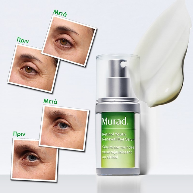 Top 3 kem dưỡng mắt chứa Retinol 'là phẳng' mọi nếp nhăn - Ảnh 5. Top 3 kem dưỡng mắt chứa Retinol 'là phẳng' mọi nếp nhăn - Ảnh 5.