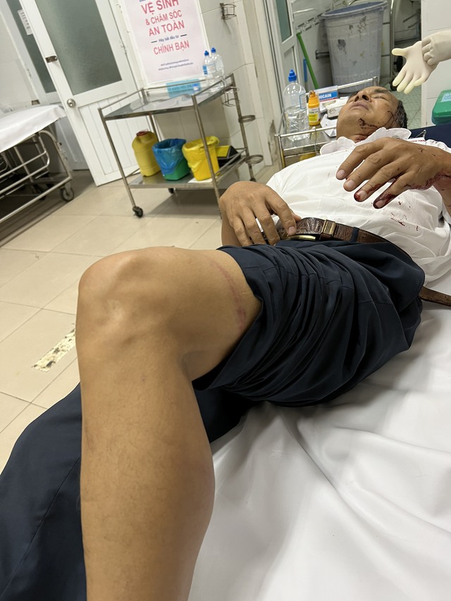 Ninh Thuận: Một nhân viên nhà máy nhiệt điện bị đánh trọng thương giữa ban ngày - Ảnh 3.