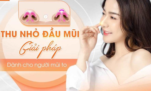 Sự thật về phương pháp thu nhỏ đầu mũi không phẫu thuật - Ảnh 1.