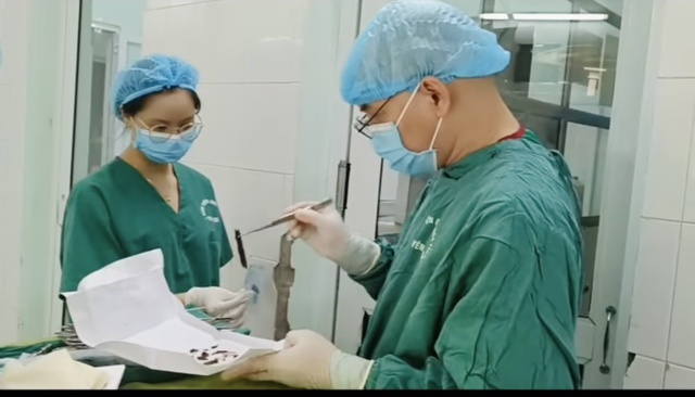 Áp xe ruột do thanh nứa nhỏ ghim trong ổ bụng - Ảnh 1. Áp xe ruột do thanh nứa nhỏ ghim trong ổ bụng - Ảnh 1.