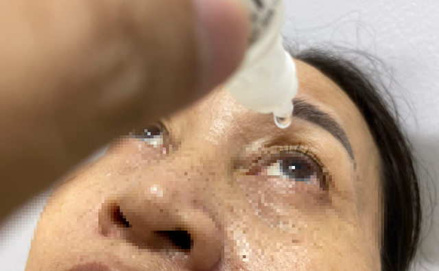 Hơn 71.000  lượt khám chữa bệnh đau mắt đỏ, Sở Y tế TP.HCM báo động - Ảnh 1.