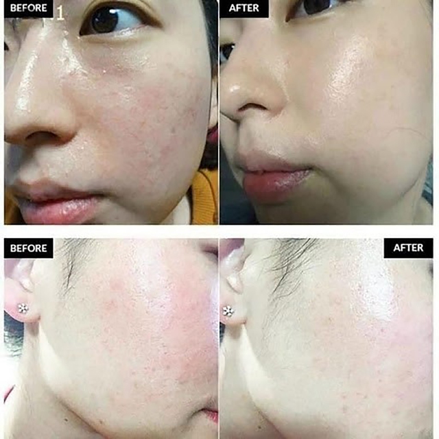 Top 10 kem dưỡng da căng bóng ngậm nước ngăn ngừa lão hóa- Ảnh 14. Top 10 kem dưỡng da căng bóng ngậm nước ngăn ngừa lão hóa- Ảnh 14.