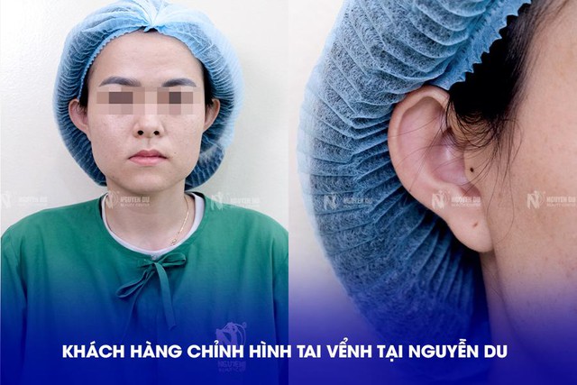 Bác sĩ Lý Tấn Việt - bác sĩ chỉnh hình tai vểnh tại TP.HCM- Ảnh 1.